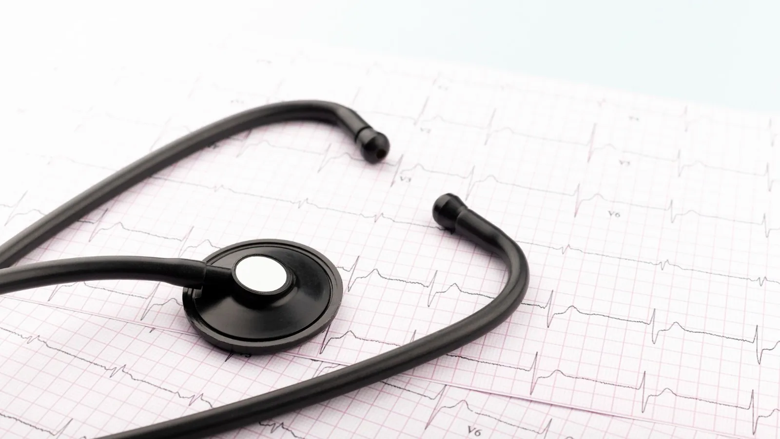 ¿Qué médico trata arritmias?