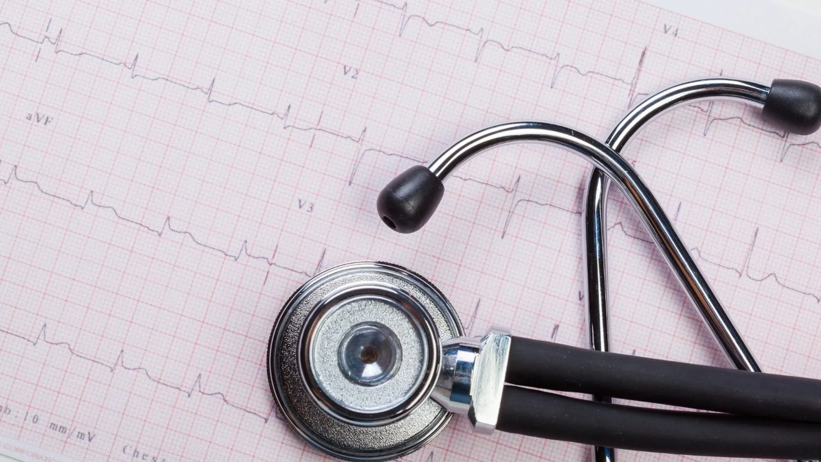 ¿Qué médico trata enfermedad coronaria?